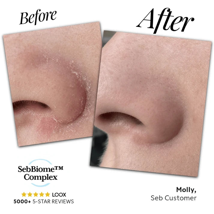 Seb Natural Calming Serum