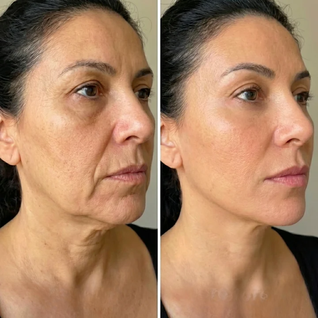 Ename | Envoltura facial de colágeno para esculpir el rostro