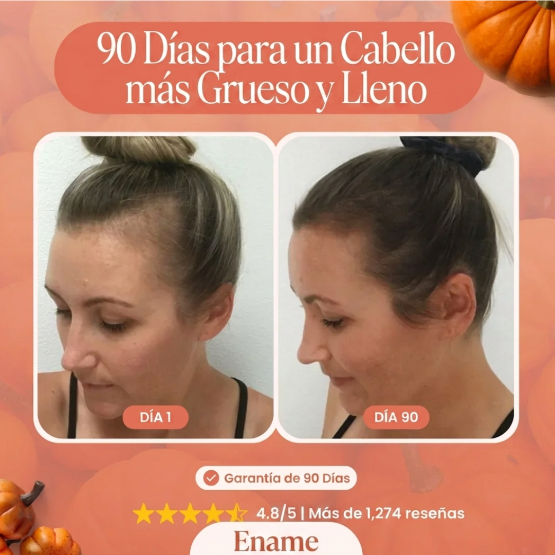 Ename | Menor caída de pelo en 26 días o menos.