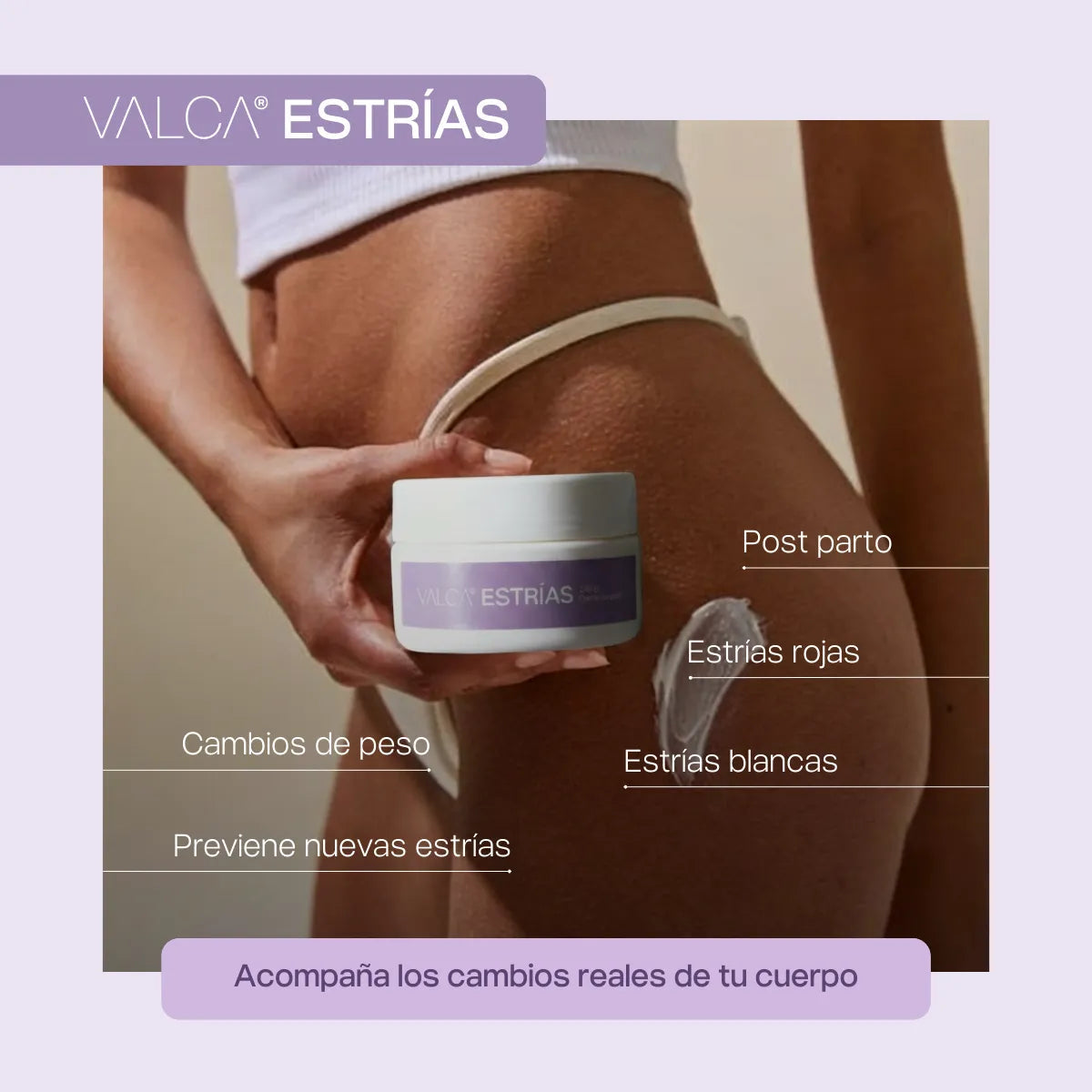 Valca Estrías® | Tratamiento estrias