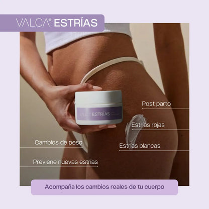 Valca Estrías® | Tratamiento estrias