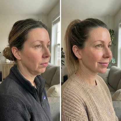 Ename | Envoltura facial de colágeno para esculpir el rostro