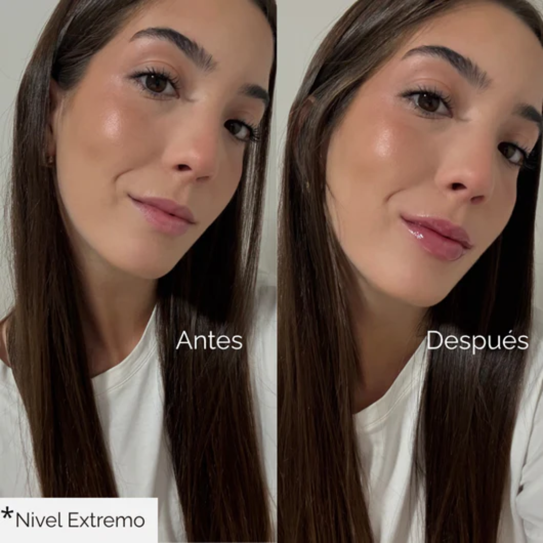 Lip Plumper