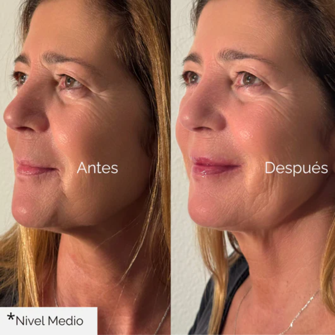 Lip Plumper