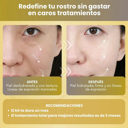 Lifting Facial en Casa | Hilos Tensores de Colágeno + Sérum 🎁