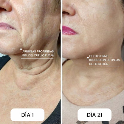 Serum Pilar - Elimina la flacidez y recupera la firmeza de tu cuello
