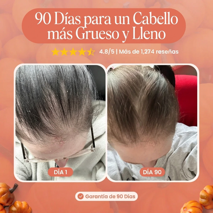 Ename | Menor caída de pelo en 26 días o menos.