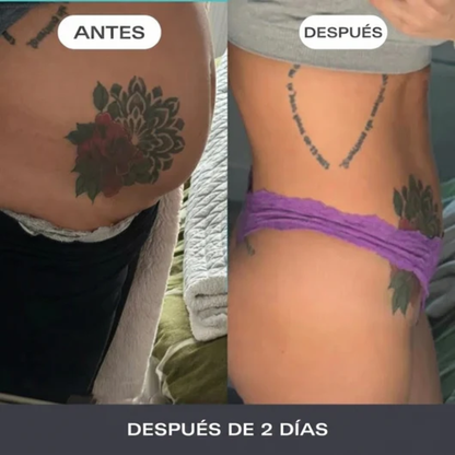 Ename - ADIOS HINCHAZÓN