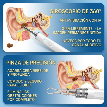 Ename VisioEar™ | Tecnología para la salud auditiva aprobada por médicos.