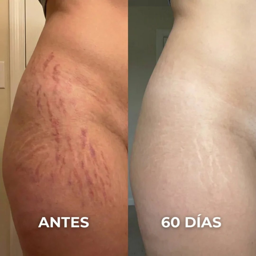 Stick Reparador de Cicatrices con Silicona Médica – Suaviza y Reduce Marcas Visibles