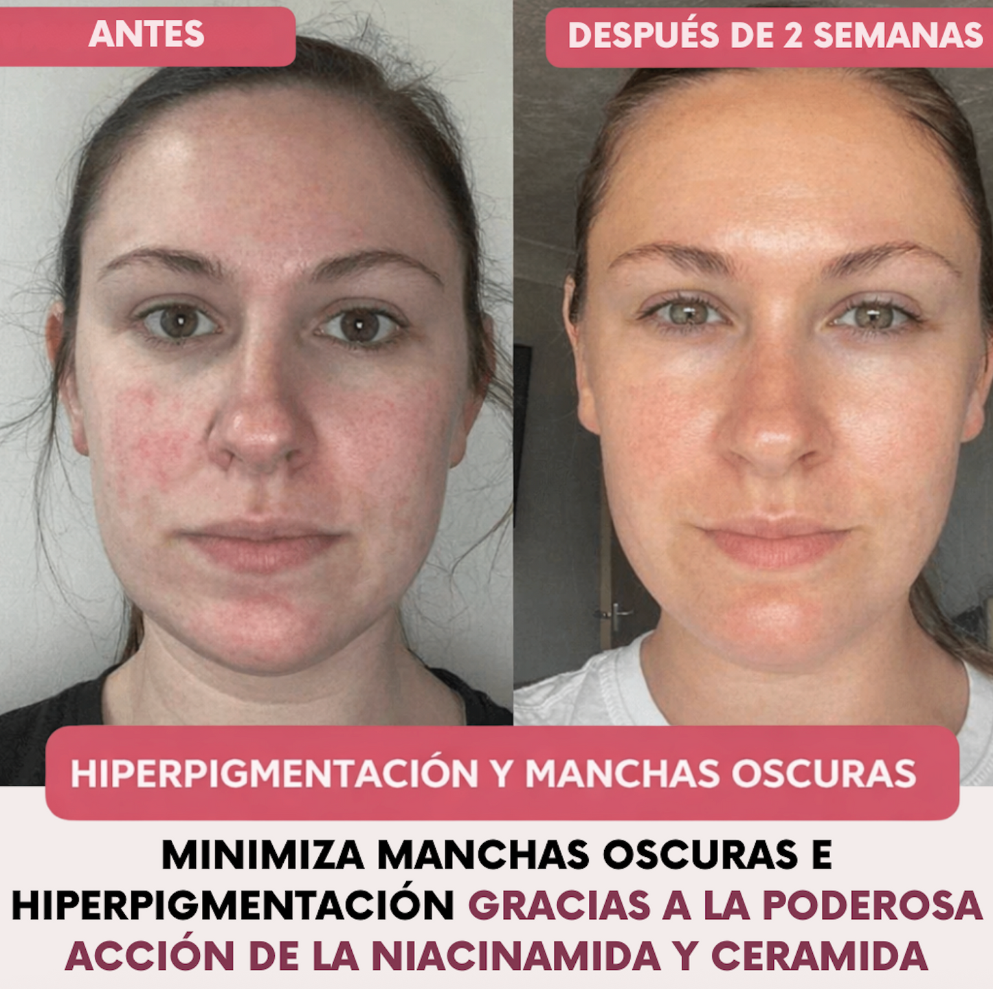 MERODA® Máscara Facial de Colágeno Avanzada + Brocha aplicadora de regalo