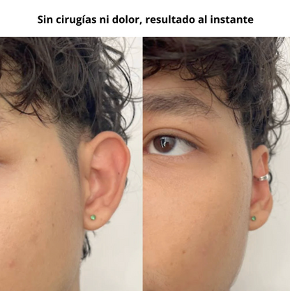 Clip Corrector de Orejas