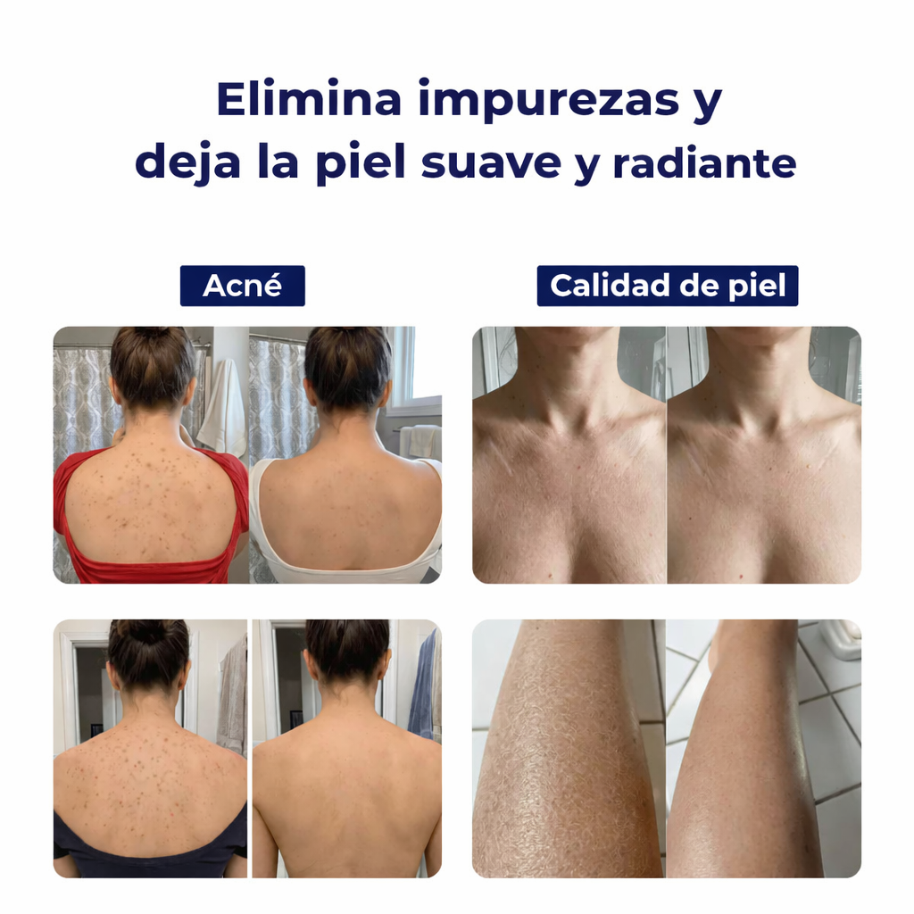 Toalla Exfoliante Antibacteriana para Ducha