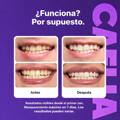 Tiras blanqueadoras de dientes moradas