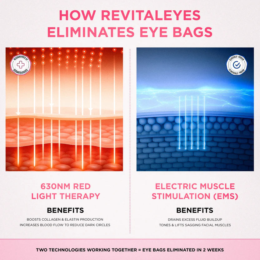 RevitalEyes® — Red Light & EMS Device for Hormone-Related Under-Eye Puffiness