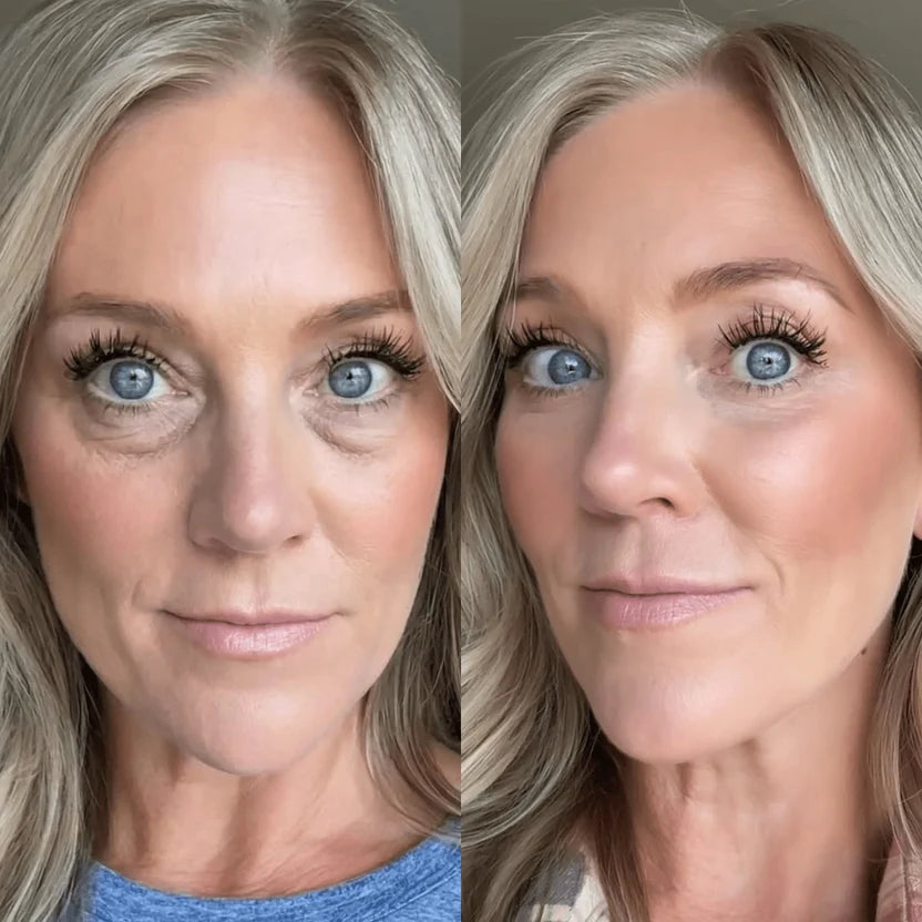 RevitalEyes® — Red Light & EMS Device for Hormone-Related Under-Eye Puffiness