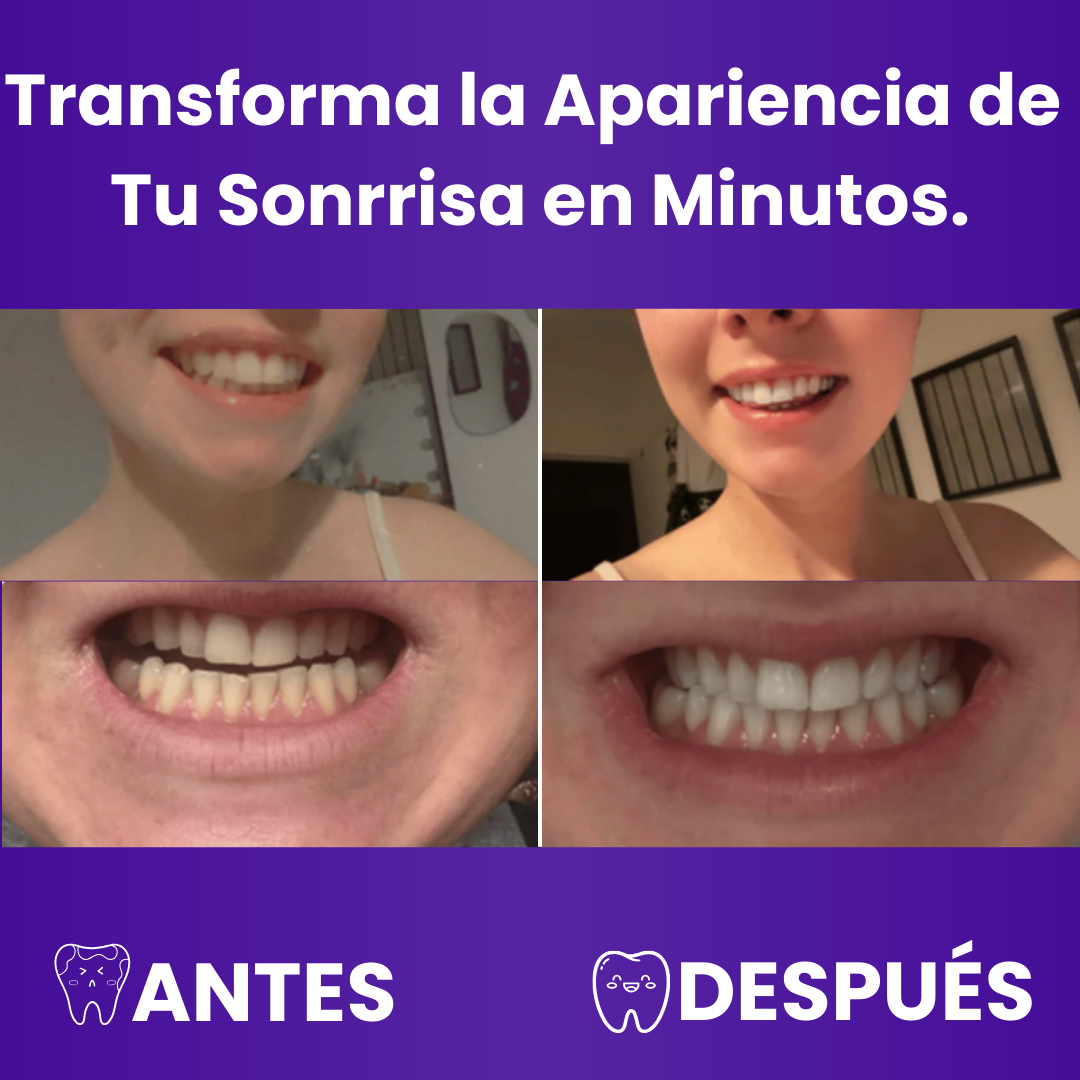 Tiras blanqueadoras de dientes moradas