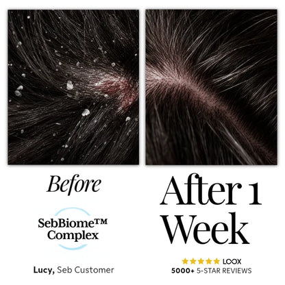 Seb Natural Calming Serum