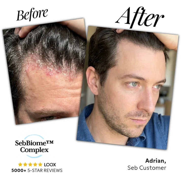 Seb Natural Calming Serum