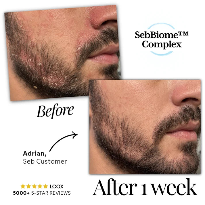 Seb Natural Calming Serum