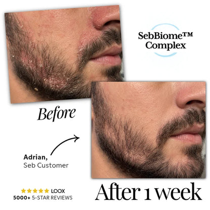 Seb Natural Calming Serum