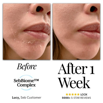 Seb Natural Calming Serum