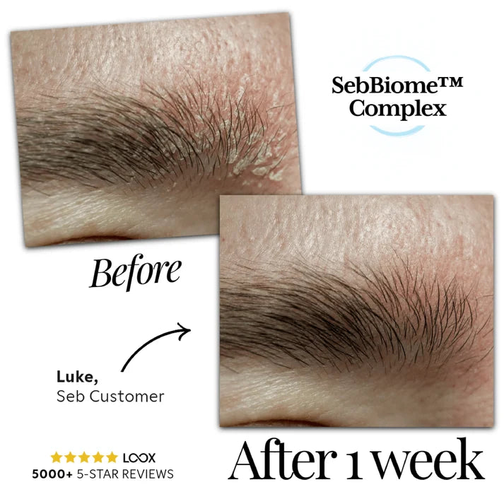Seb Natural Calming Serum