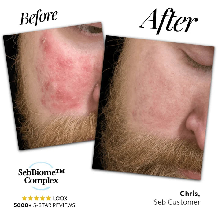 Seb Natural Calming Serum