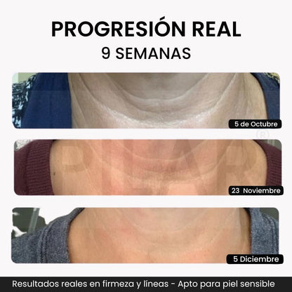 Serum Pilar - Elimina la flacidez y recupera la firmeza de tu cuello