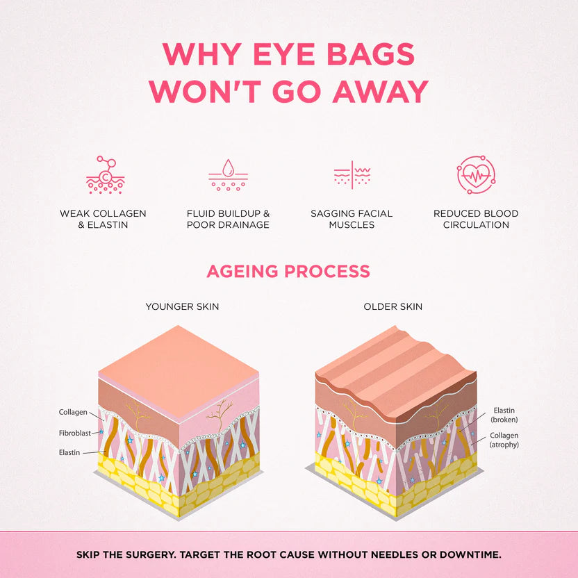 RevitalEyes® — Red Light & EMS Device for Hormone-Related Under-Eye Puffiness